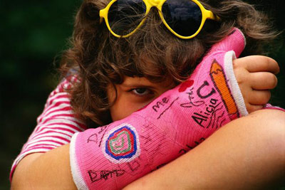 injured girl with cast on wrist PHOTO